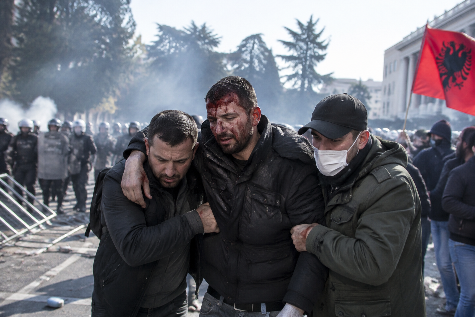 Albanian anti-government clashes enter seventh day, leaving nearly 300 injured